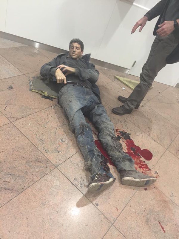 Slightly wounded civilian at Zaventem airport.